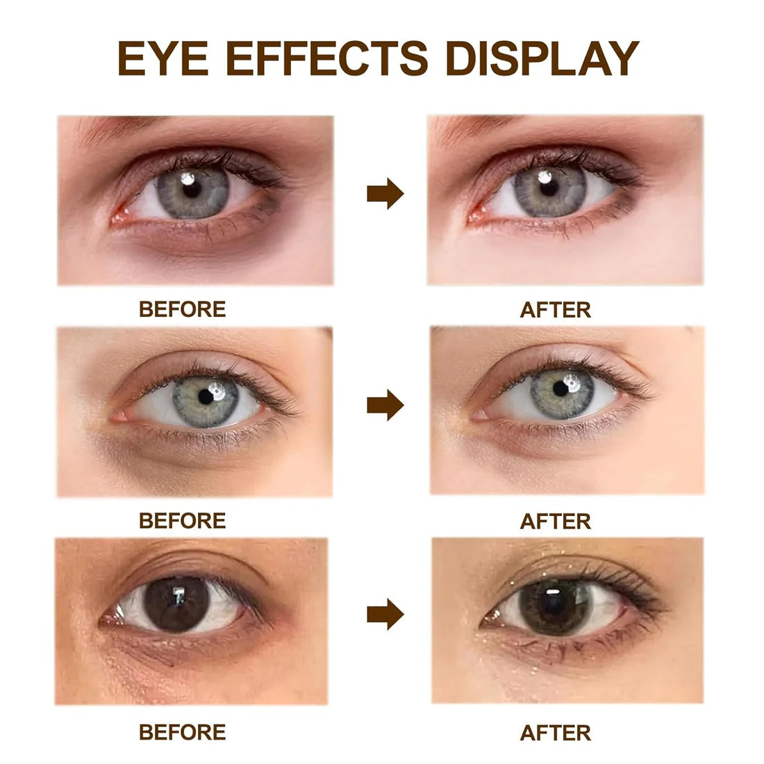 Dr. Melaxin Eyephalt Eyebag Cream – Best Eye Cream for Dark Circles & Puffy Eyes