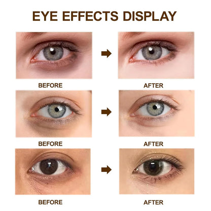 Dr. Melaxin Eyephalt Eyebag Cream – Best Eye Cream for Dark Circles & Puffy Eyes