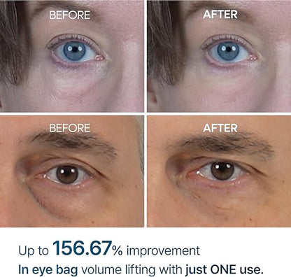 Dr. Melaxin Eyephalt Eyebag Cream – Best Eye Cream for Dark Circles & Puffy Eyes